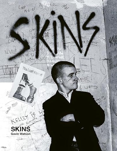 Gavin Watson: Skins