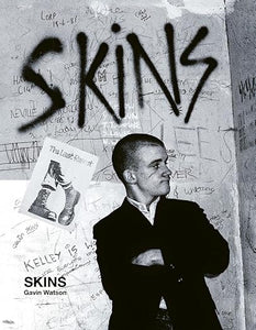 Gavin Watson: Skins