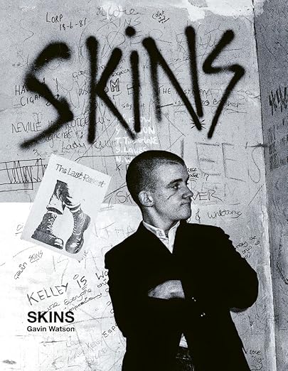 Gavin Watson: Skins